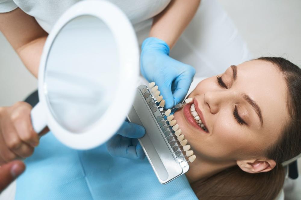 Dental Veneers Adelaide 
